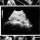 Illustration for article titled Woman Files First Lawsuit Challenging Fetal Pain Laws